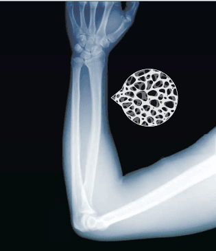 X-Ray Machine in use